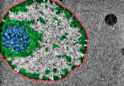 An electron microscopy image of a cell with the nucleolus shown in blue, chromatin in green, and nuclear envelope in red